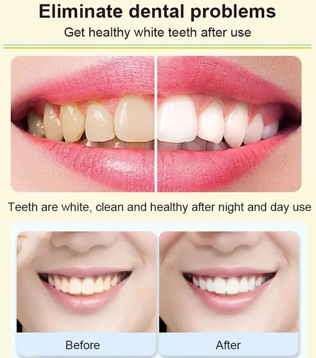 Probiotics whitening toothpaste